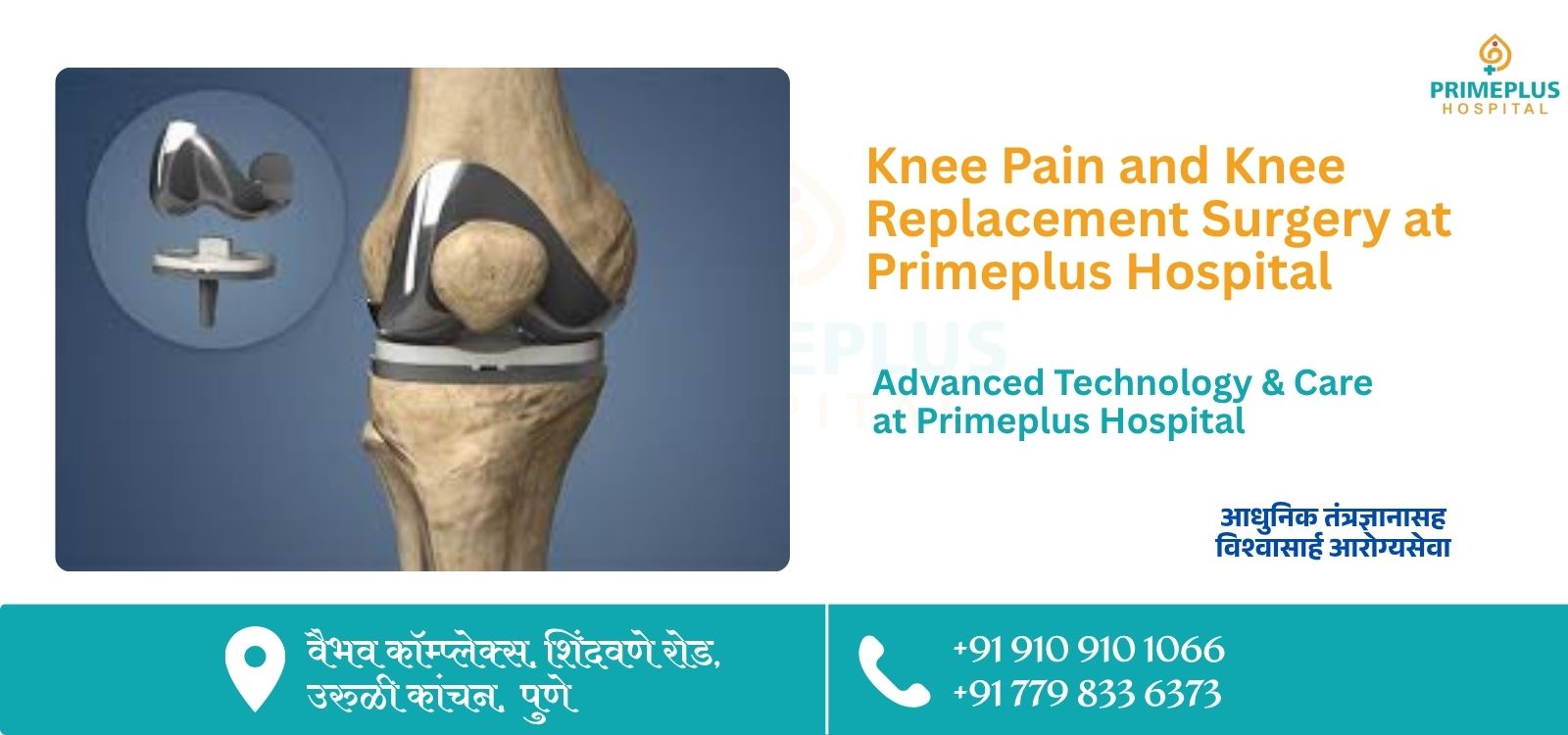 Knee Pain and Knee Replacement Surgery at Primeplus Hospital in Uruli Kanchan